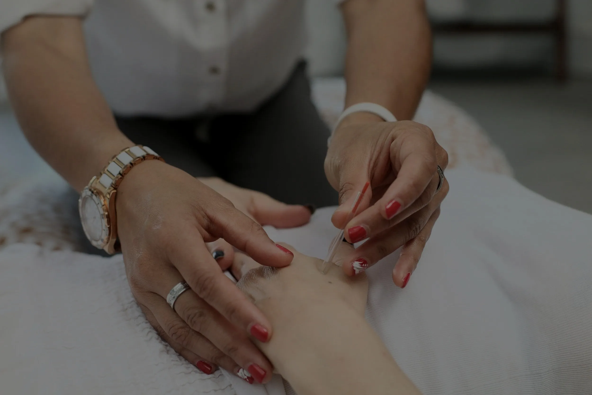 A practitioner placing a fine acupuncture needle in a patient’s forearm.
