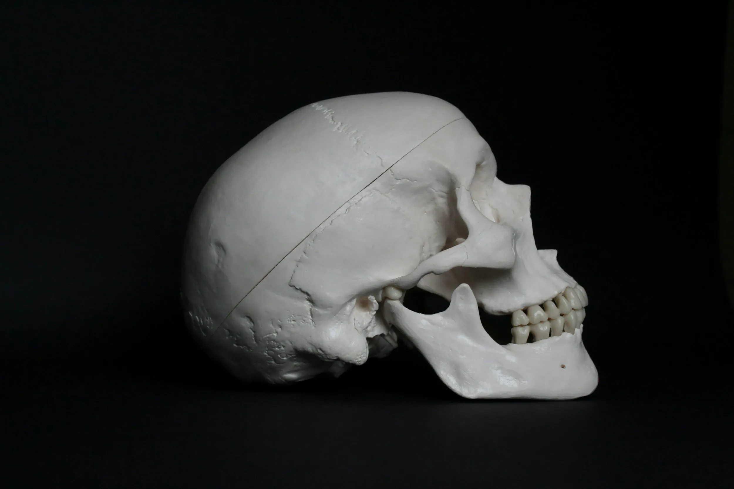A human skull in profile, lit against black, showing the temporomandibular joint.